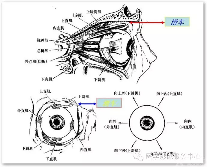 眼部滑车钙化