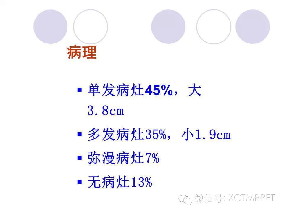中枢神经系统原发淋巴瘤