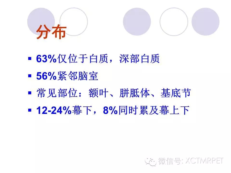 中枢神经系统原发淋巴瘤