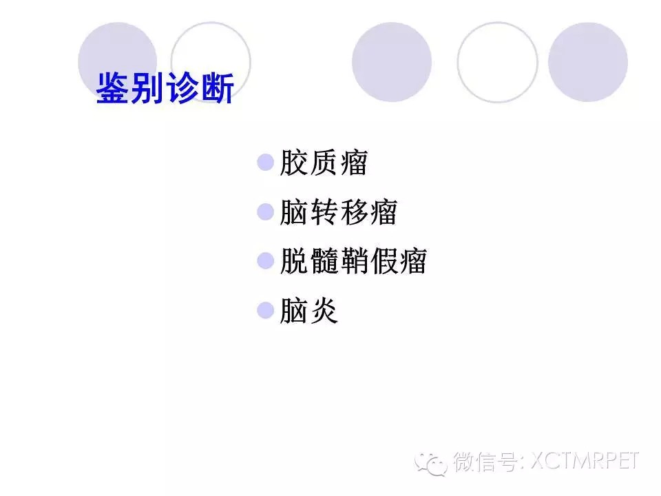 中枢神经系统原发淋巴瘤