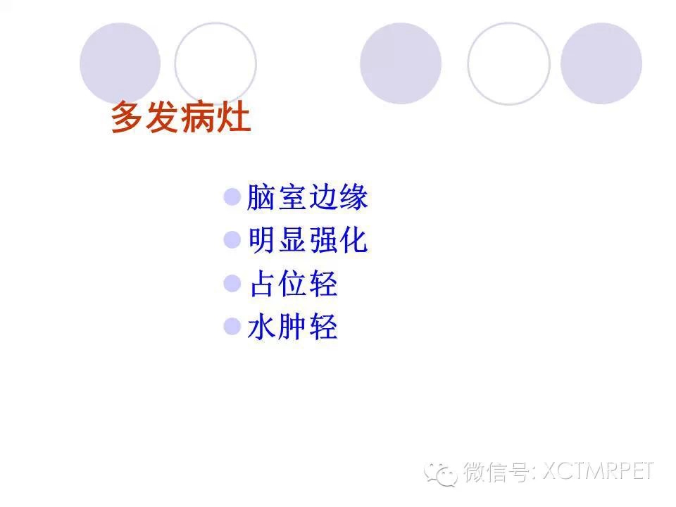 中枢神经系统原发淋巴瘤
