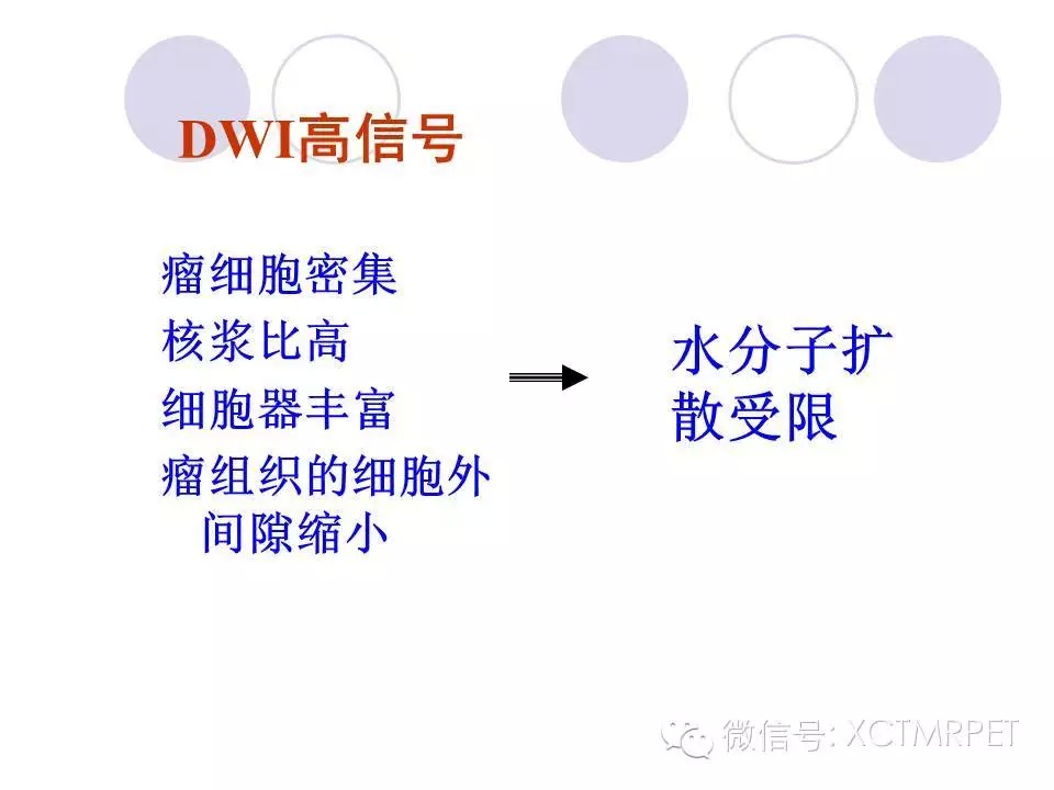 中枢神经系统原发淋巴瘤
