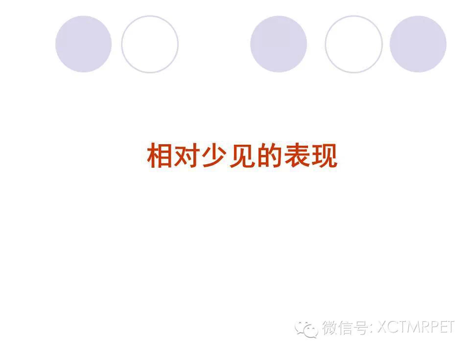 中枢神经系统原发淋巴瘤