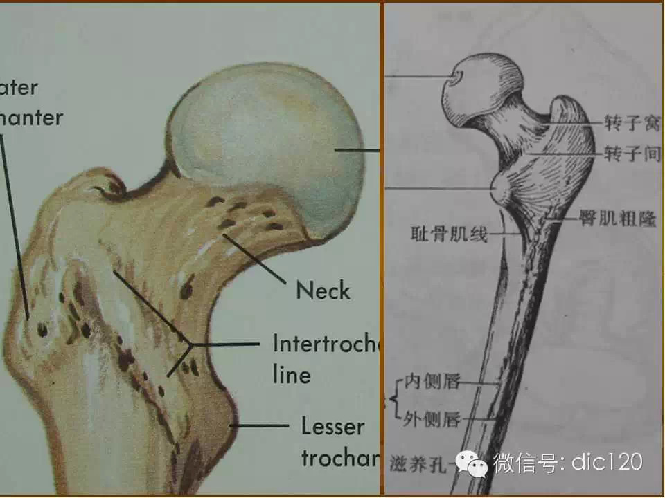 股骨头缺血坏死的影像学表现