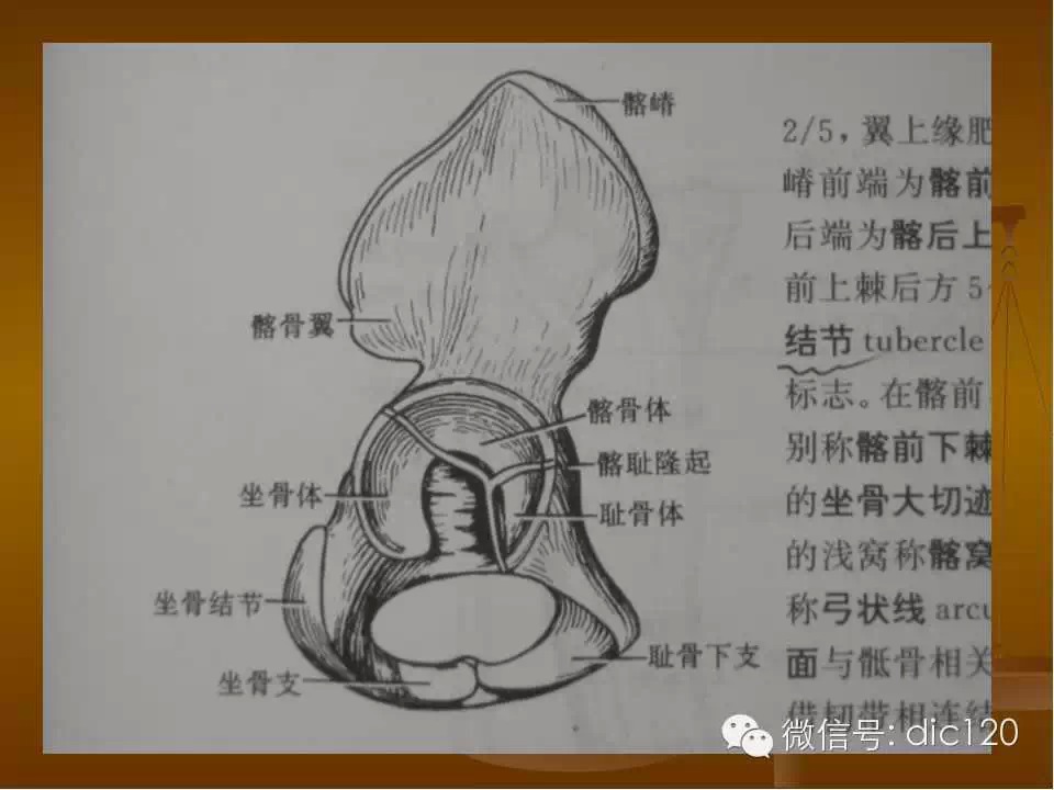 股骨头缺血坏死的影像学表现