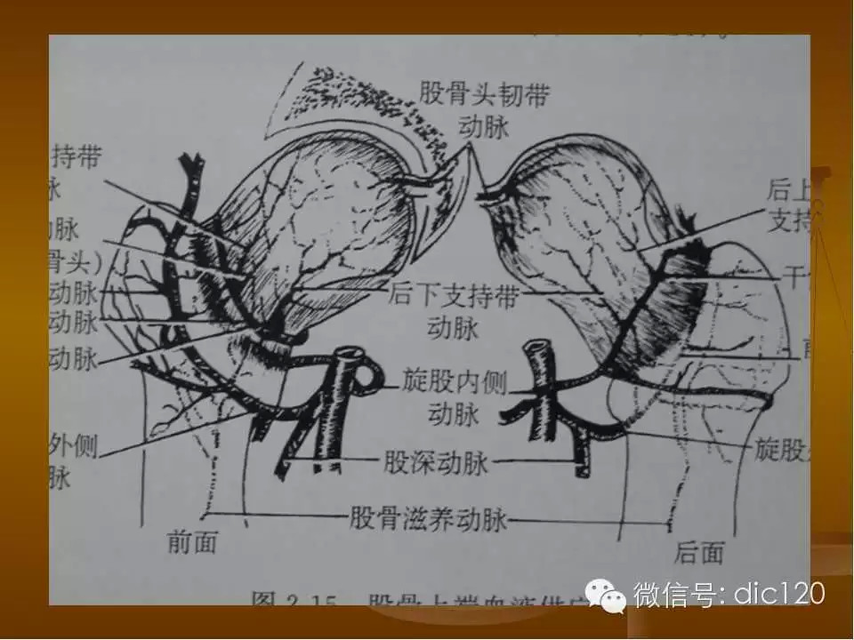 股骨头缺血坏死的影像学表现