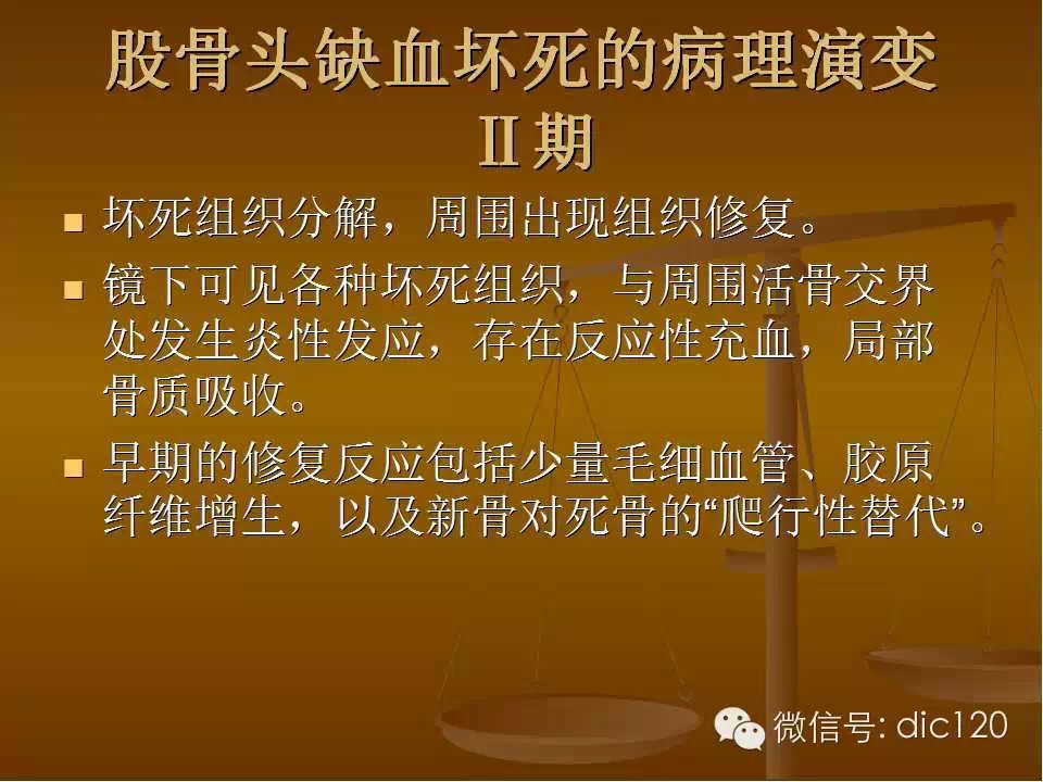 股骨头缺血坏死的影像学表现