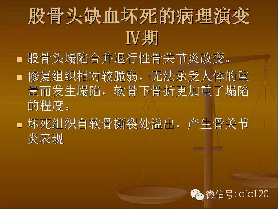 股骨头缺血坏死的影像学表现