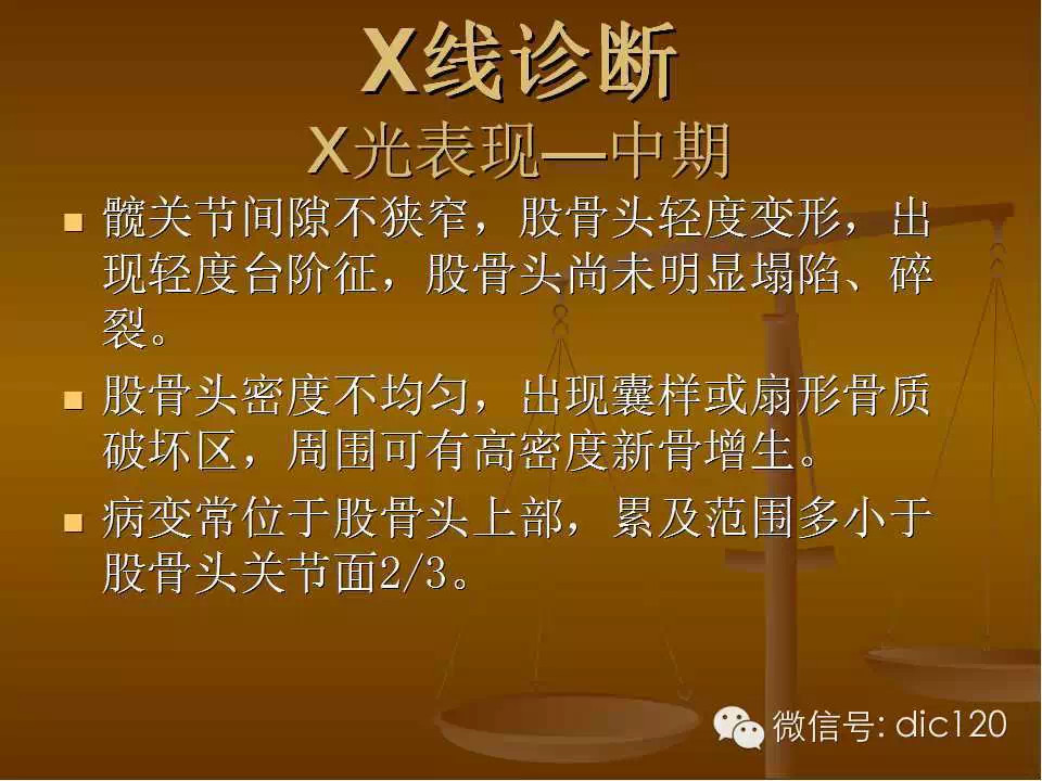 股骨头缺血坏死的影像学表现