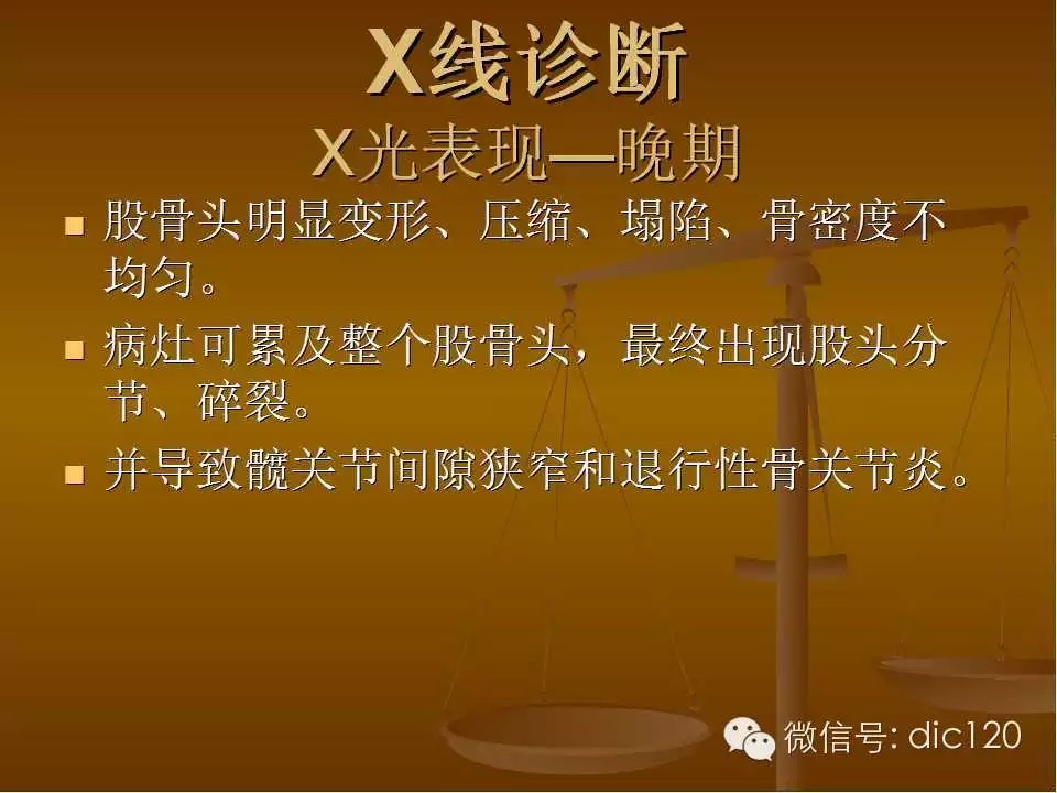 股骨头缺血坏死的影像学表现