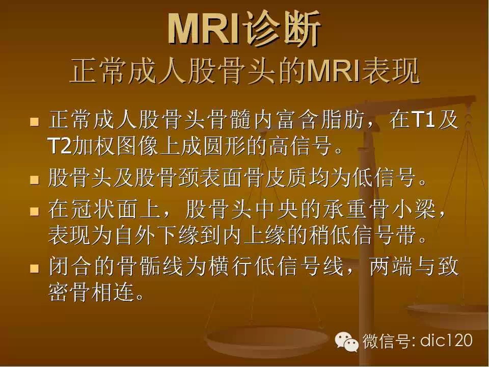 股骨头缺血坏死的影像学表现