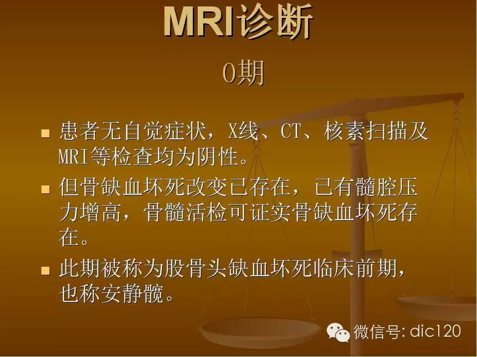 股骨头缺血坏死的影像学表现