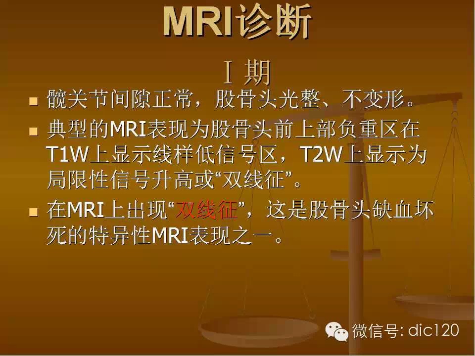 股骨头缺血坏死的影像学表现