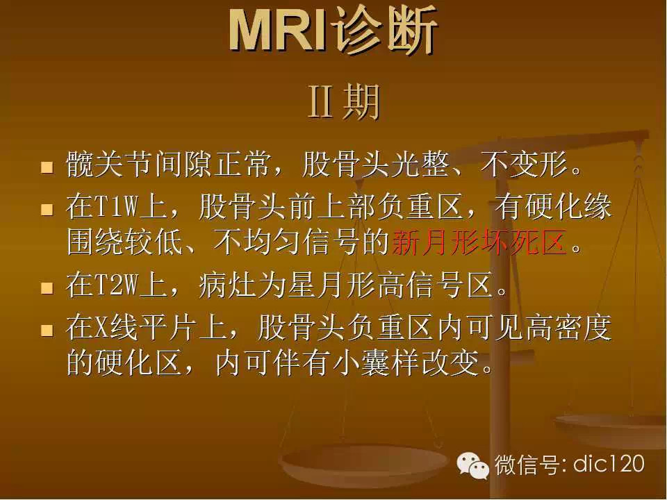 股骨头缺血坏死的影像学表现