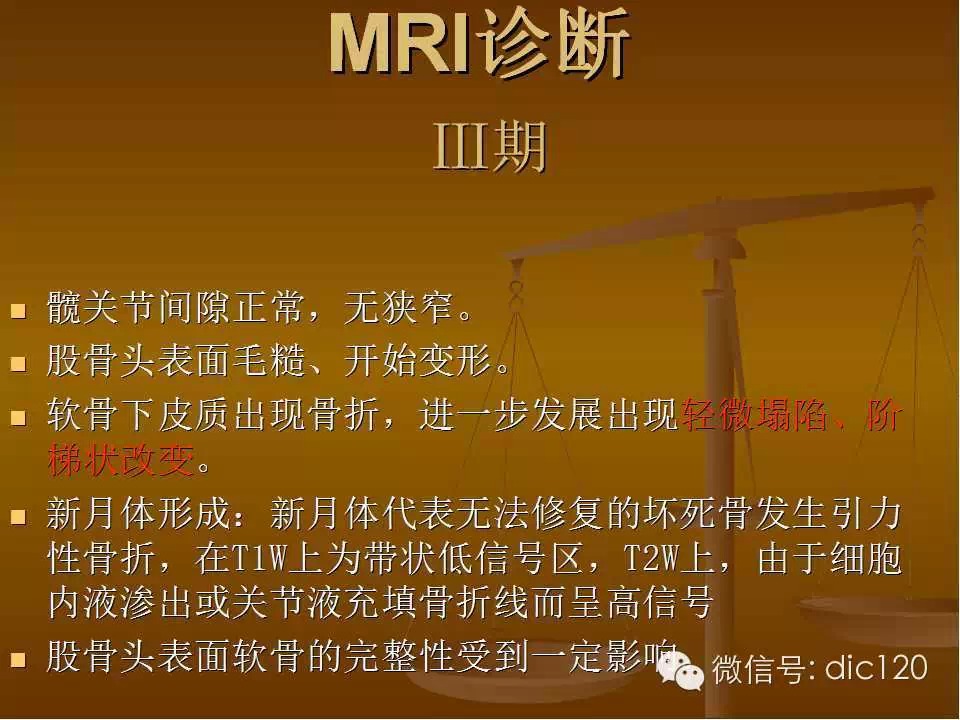股骨头缺血坏死的影像学表现