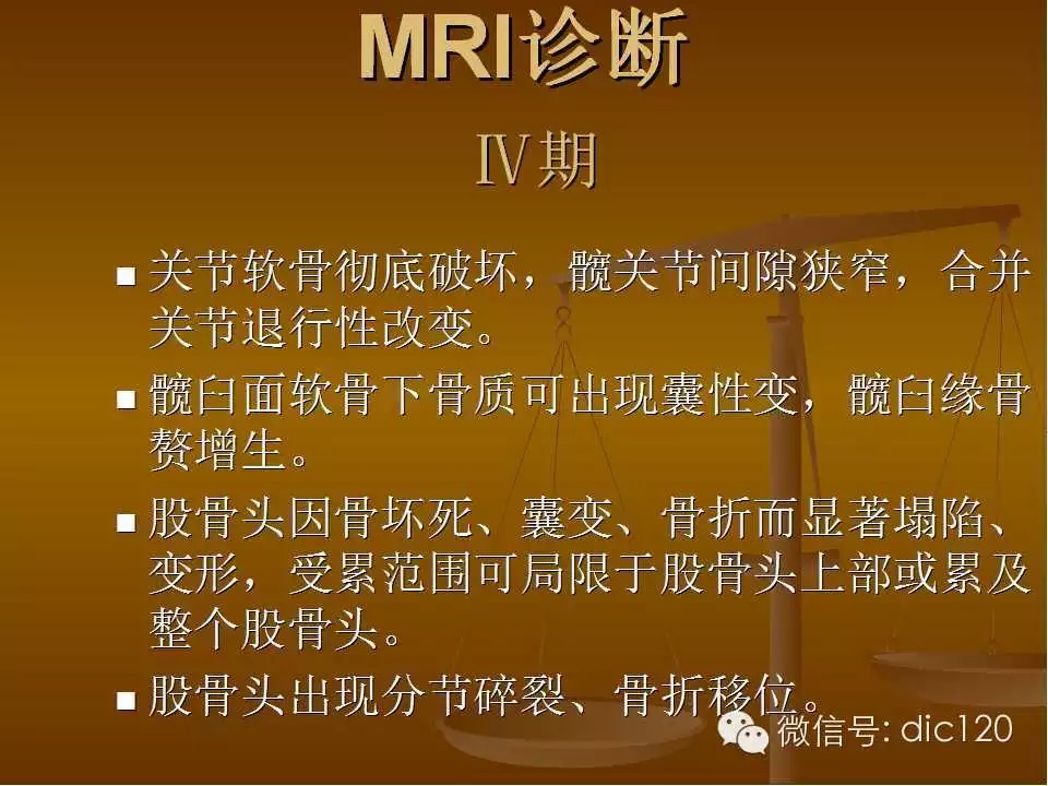 股骨头缺血坏死的影像学表现