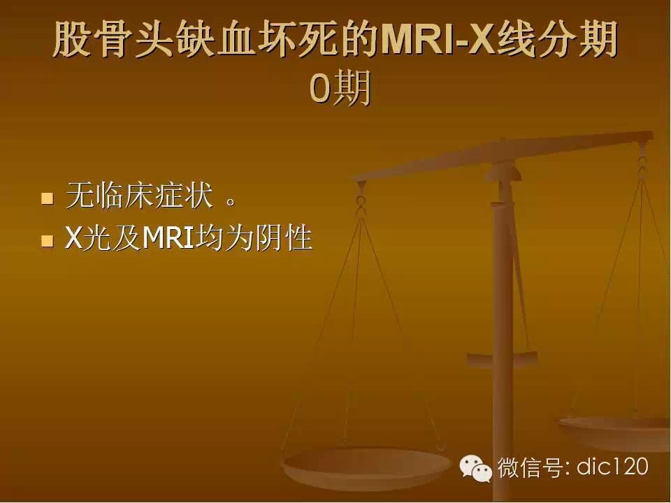 股骨头缺血坏死的影像学表现