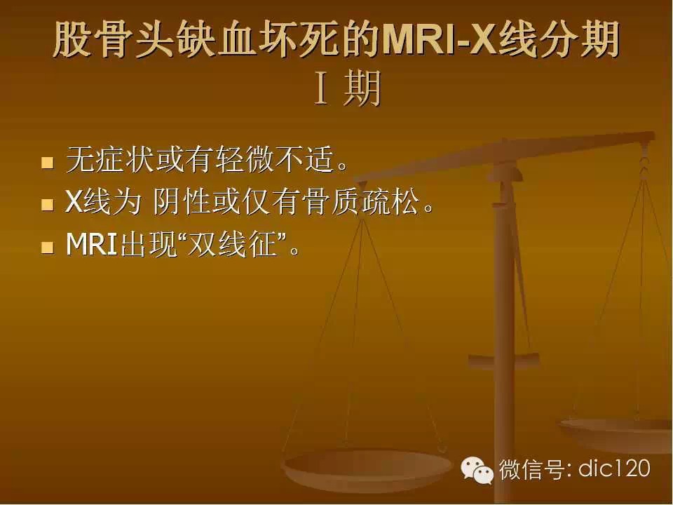 股骨头缺血坏死的影像学表现