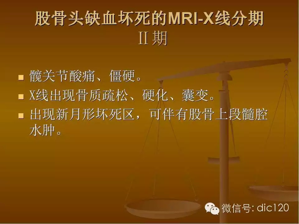 股骨头缺血坏死的影像学表现