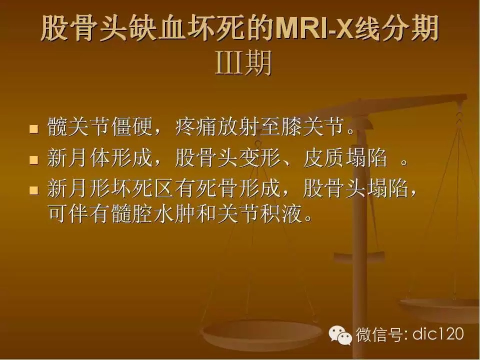 股骨头缺血坏死的影像学表现