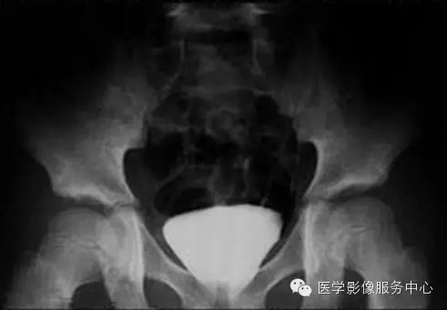 腹部X线摄影立位、仰卧位、侧卧位和斜位的临床意义 腹部X线摄影立位、仰卧位、侧卧位和斜位的临床意义