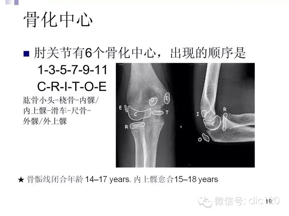 儿童肘关节骨折X线诊断
