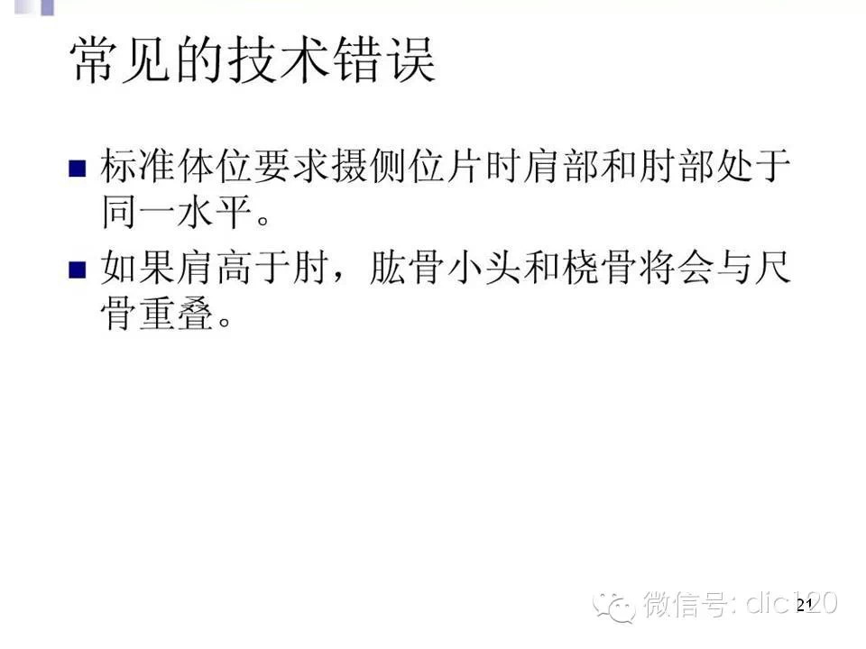 儿童肘关节骨折X线诊断