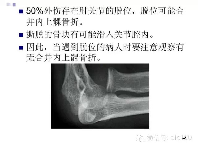 儿童肘关节骨折X线诊断