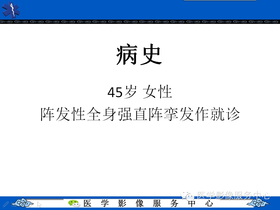 【病例学习】胚胎发育不良性神经上皮瘤一例影像诊断与鉴别