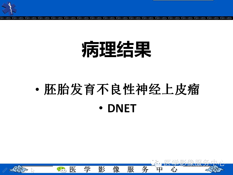 【病例学习】胚胎发育不良性神经上皮瘤一例影像诊断与鉴别