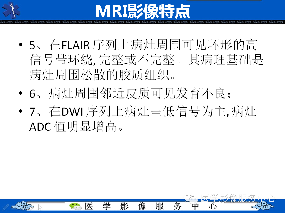 【病例学习】胚胎发育不良性神经上皮瘤一例影像诊断与鉴别