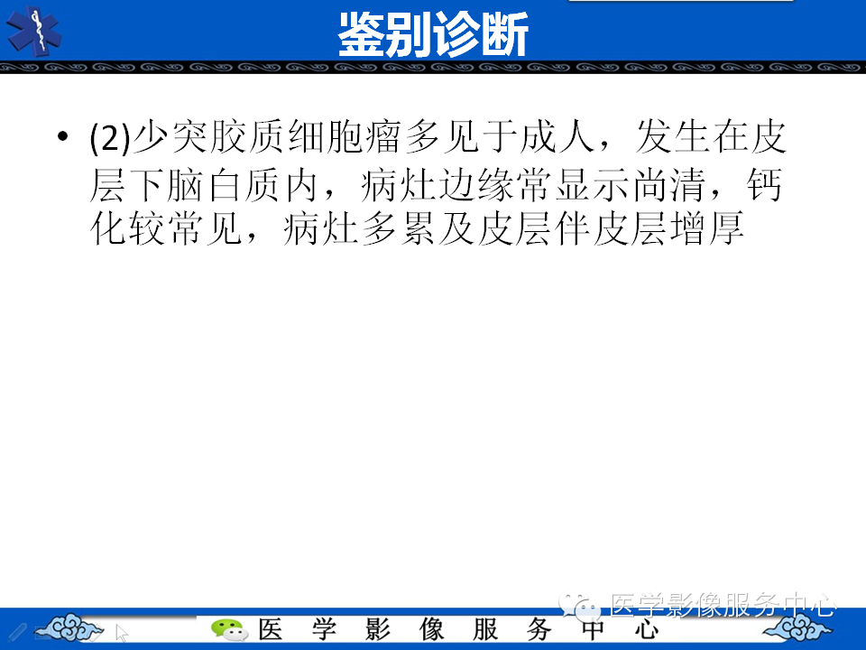 【病例学习】胚胎发育不良性神经上皮瘤一例影像诊断与鉴别