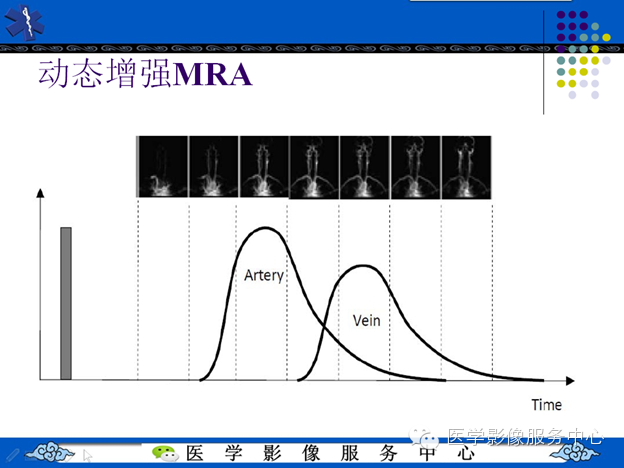 MRI血管造影