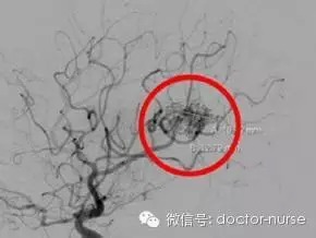 头颅CT图片及详解---年轻医师轻松学 头颅CT图片及详解---年轻医师轻松学