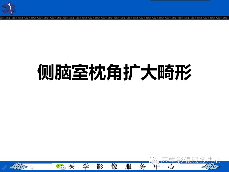 侧脑室枕角扩大畸形