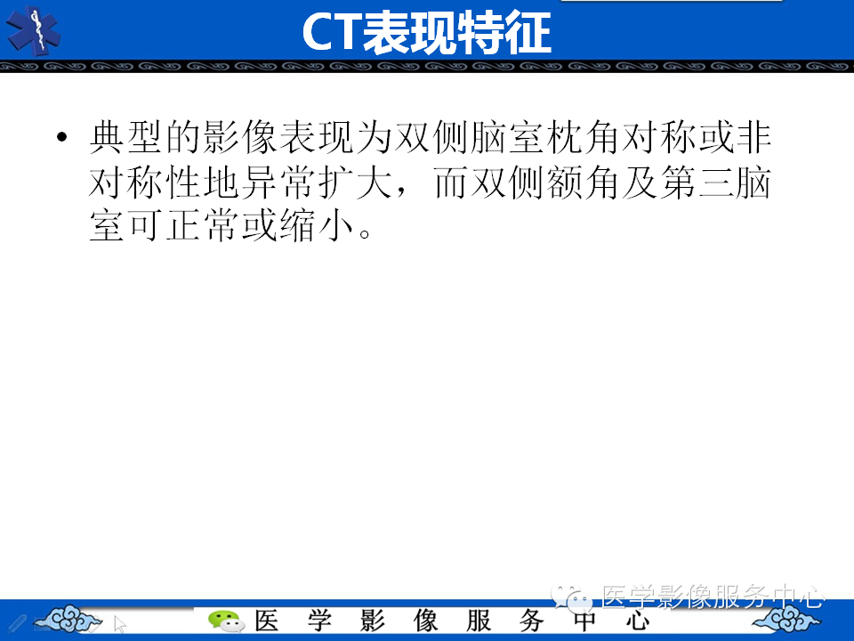 侧脑室枕角扩大畸形