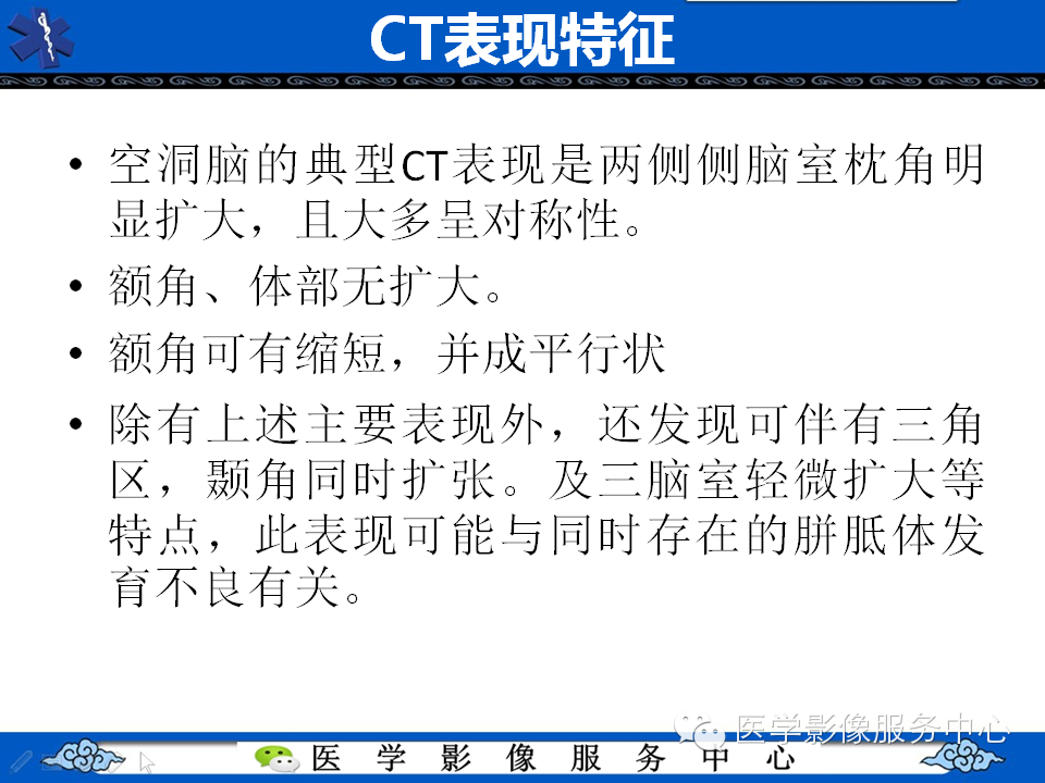 侧脑室枕角扩大畸形