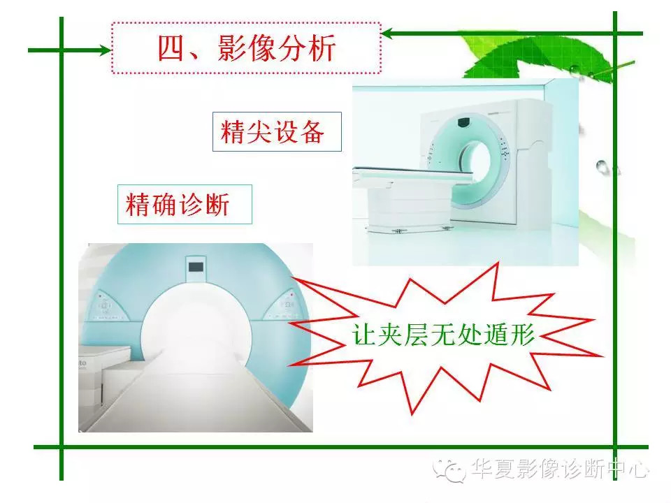 主动脉夹层的影像诊断