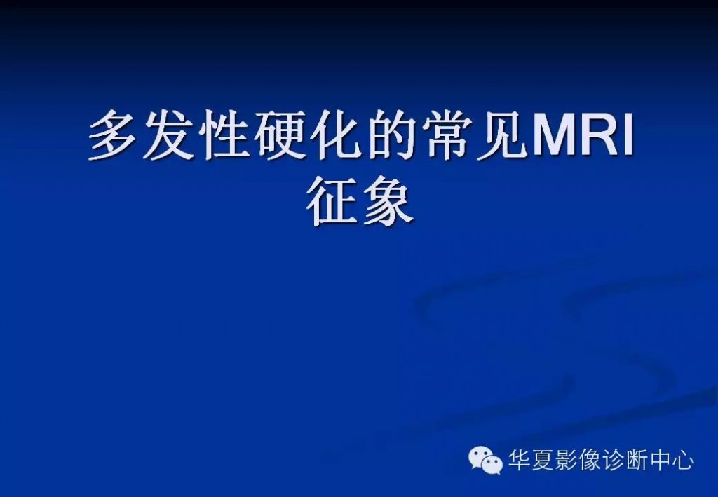 多发性硬化的常见MRI征象