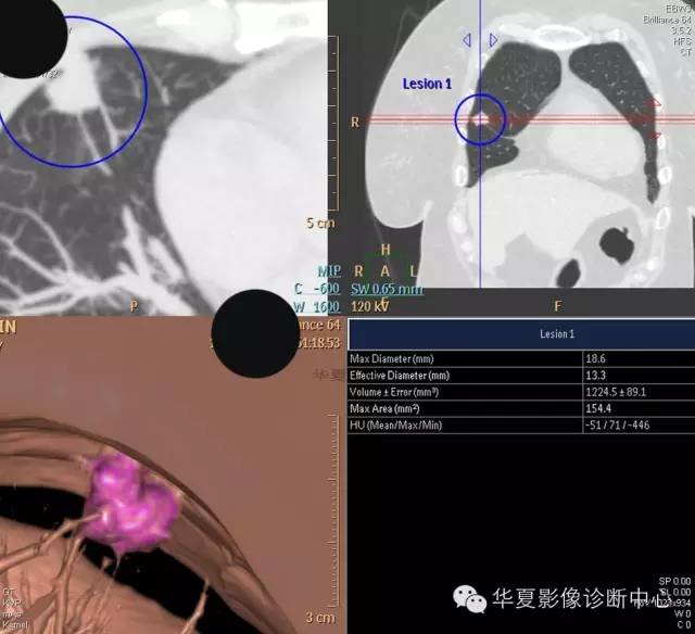 【病例学习】 【病例学习】