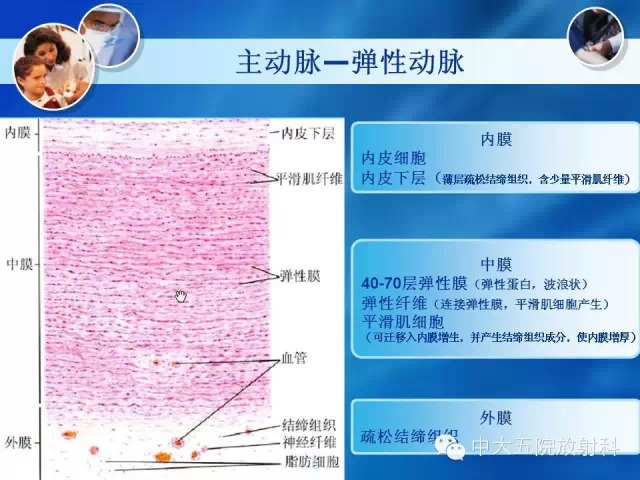 主动脉病变病理基础和影像表现