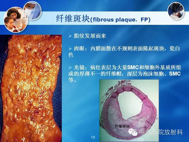 主动脉病变病理基础和影像表现