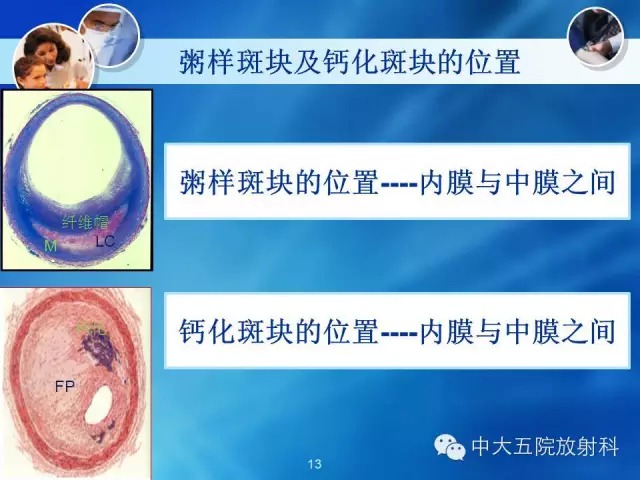 主动脉病变病理基础和影像表现