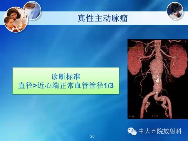 主动脉病变病理基础和影像表现