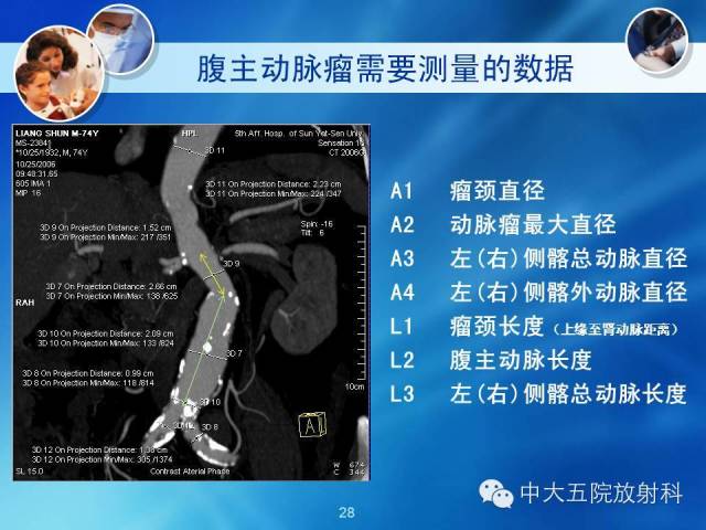 主动脉病变病理基础和影像表现