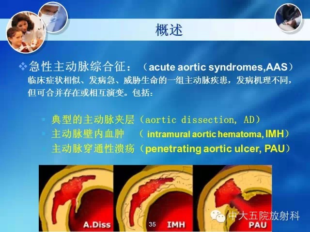 主动脉病变病理基础和影像表现