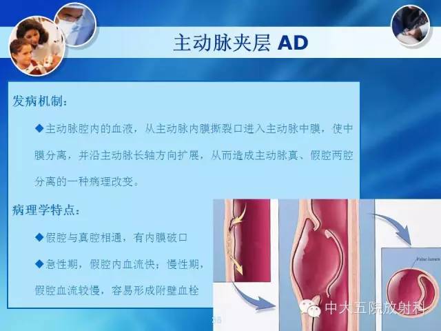 主动脉病变病理基础和影像表现