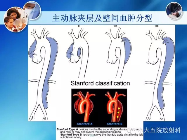 主动脉病变病理基础和影像表现