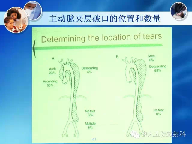 主动脉病变病理基础和影像表现