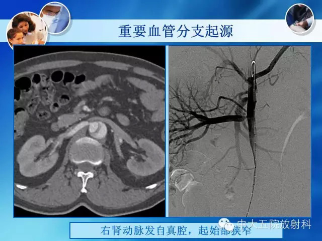 主动脉病变病理基础和影像表现